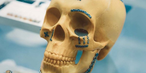 Kdo bo v prihodnje izvajal kirurško zdravljenje raka v ustni votlini, zdravil ponesrečene z izjemno hudimi poškodbami obraza ali operiral otroke, ki se rodijo s prirojeno razvojno anomalijo obraza in ustne votline?