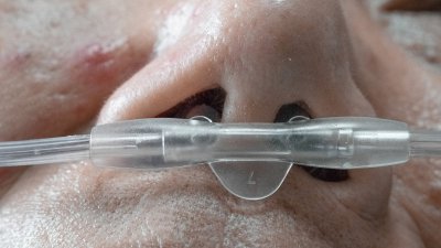 Kronična obstruktivna pljučna bolezen: naj vam ne krade diha, naredite test pljučne funkcije!