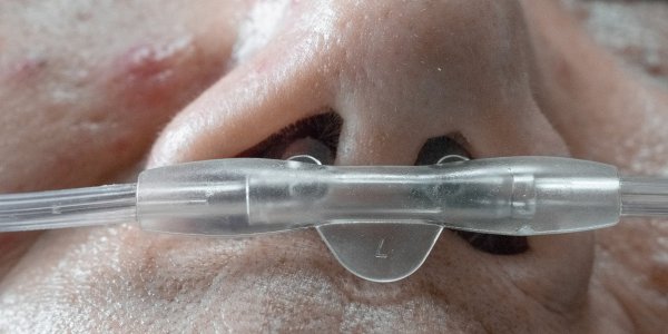 Kronična obstruktivna pljučna bolezen: naj vam ne krade diha, naredite test pljučne funkcije!