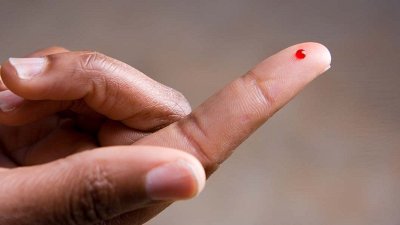 Nekajminutna naložba, ki vam lahko reši življenje: brezplačne meritve holesterola, krvnega tlaka in krvnega sladkorja 