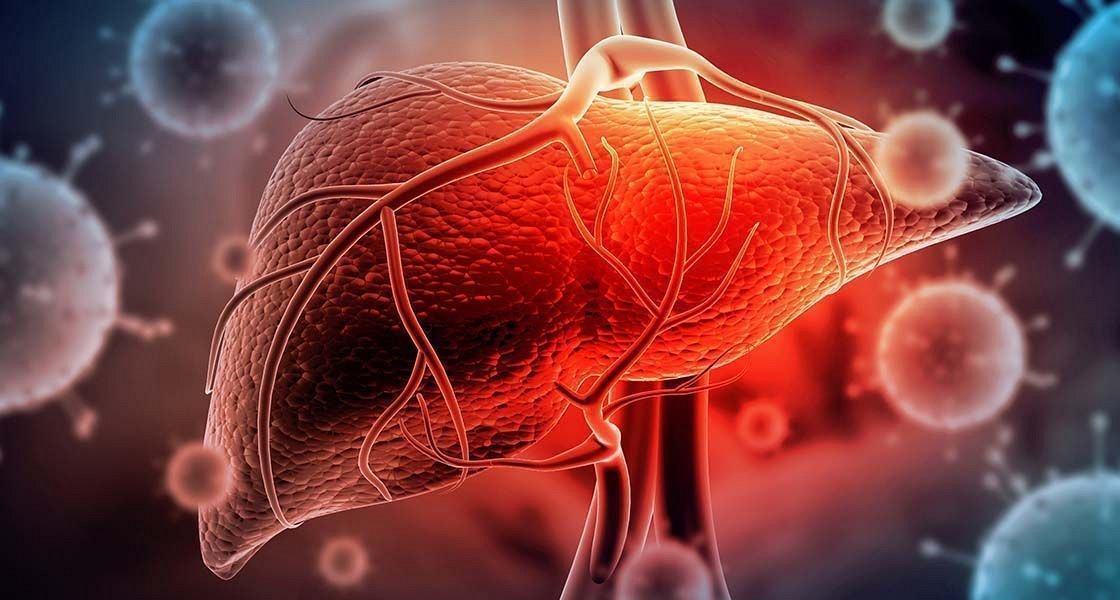 Pojavnost raka na jetrih v porastu tudi na račun okužb s hepatitisom B ali C