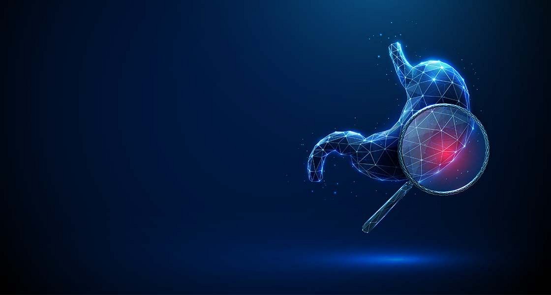 Raka želodca bi bilo mogoče preprečiti v skorajda 90-odstotnem deležu – s pravočasnim odkritjem in ozdravitvijo okužbe z bakterijo Helicobacter pylori, glavnim povzročiteljem te in številnih drugih bolezni 