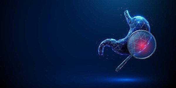 Raka želodca bi bilo mogoče preprečiti v skorajda 90-odstotnem deležu – s pravočasnim odkritjem in ozdravitvijo okužbe z bakterijo Helicobacter pylori, glavnim povzročiteljem te in številnih drugih bolezni 