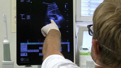 Spodbudni obeti za zdravljenje napredovalega raka prostate z naprednim avtolognim celičnim zdravilom nove generacije – dosežek slovenskih znanstvenikov in raziskovalcev