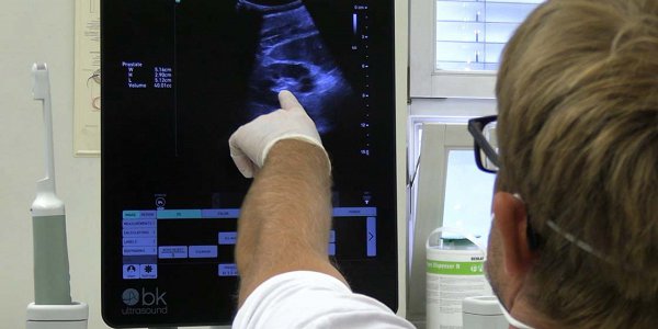 Spodbudni obeti za zdravljenje napredovalega raka prostate z naprednim avtolognim celičnim zdravilom nove generacije – dosežek slovenskih znanstvenikov in raziskovalcev