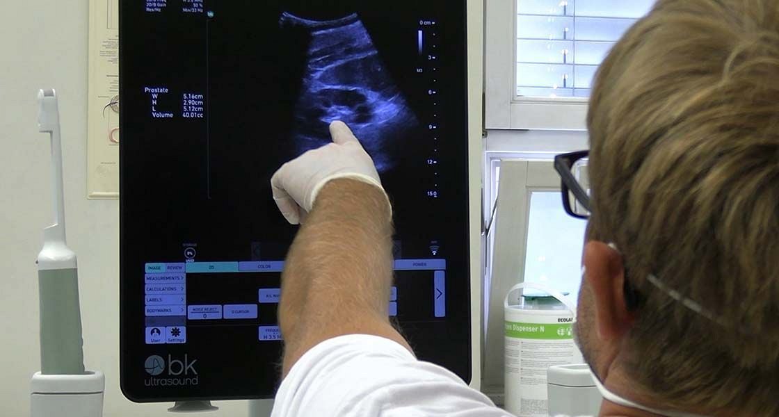 Spodbudni obeti za zdravljenje napredovalega raka prostate z naprednim avtolognim celičnim zdravilom nove generacije – dosežek slovenskih znanstvenikov in raziskovalcev