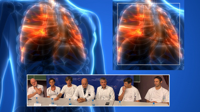 Transplantacije pljuč bodo odslej po najboljši možni uverturi – uspešni presaditvi obeh pljučnih kril – izvajali v UKC Ljubljana