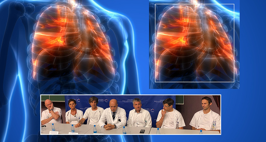 Transplantacije pljuč bodo odslej po najboljši možni uverturi – uspešni presaditvi obeh pljučnih kril – izvajali v UKC Ljubljana