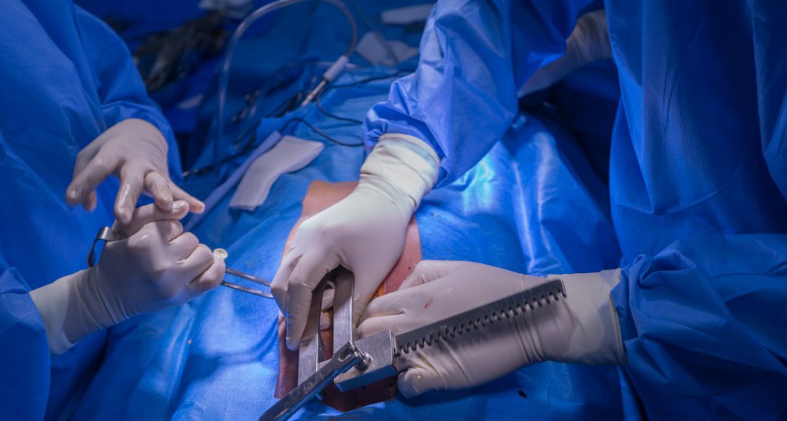 Večna dilema glede odvzema organov za presaditev: ali je mrtva oseba morda še živa?