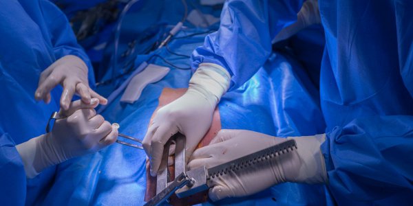 Večna dilema glede odvzema organov za presaditev: ali je mrtva oseba morda še živa?