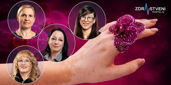 Vitiligo, avtoimunsko obolenje, pri katerem imunski sistem obolelega napade sebi lastne strukture – zdravila zanj ni, vendar obstaja veliko možnosti za lajšanje stisk in preprečevanje stigme