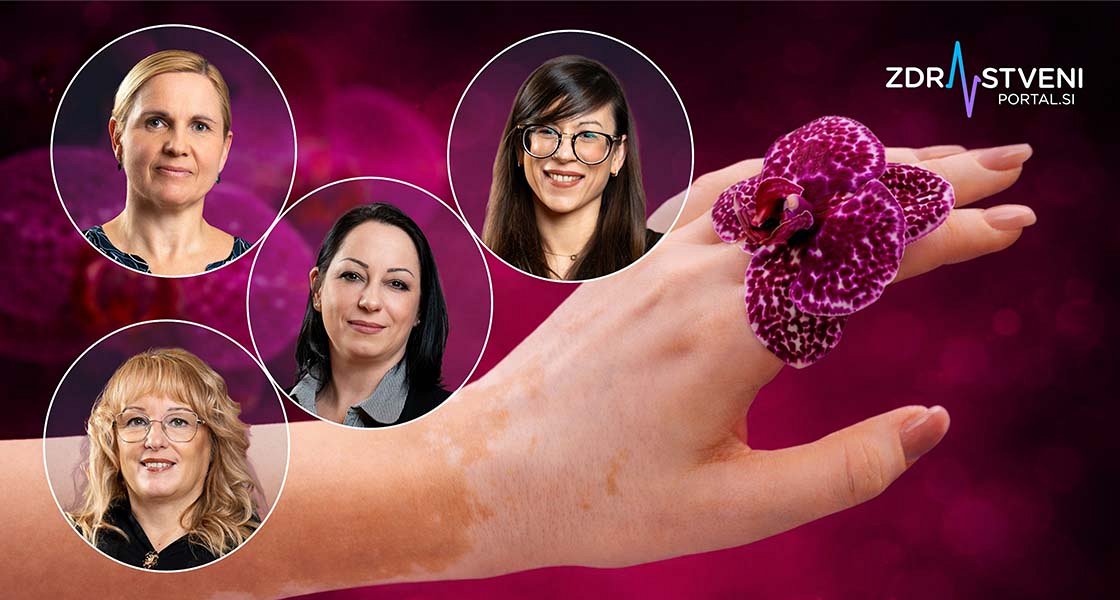 Vitiligo, avtoimunsko obolenje, pri katerem imunski sistem obolelega napade sebi lastne strukture – zdravila zanj ni, vendar obstaja veliko možnosti za lajšanje stisk in preprečevanje stigme