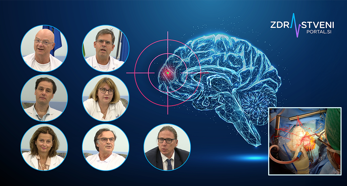 Zagon programa kirurškega zdravljenja žariščne epilepsije, pri kateri zdravljenje z zdravili ni učinkovito: pacientka s kavernomom po operaciji nima več napadov, prej jih je imela tudi do 20 na dan