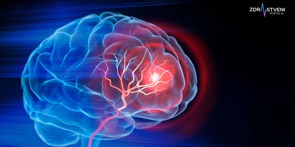 Zgodbe, ki potrjujejo, da je življenje po možganski kapi oziroma cerebrovaskularnem inzultu lahko polno, kakovostno in uspešno 