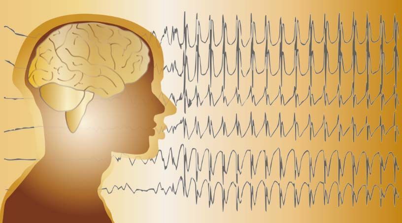 zdravljenje epilepsije