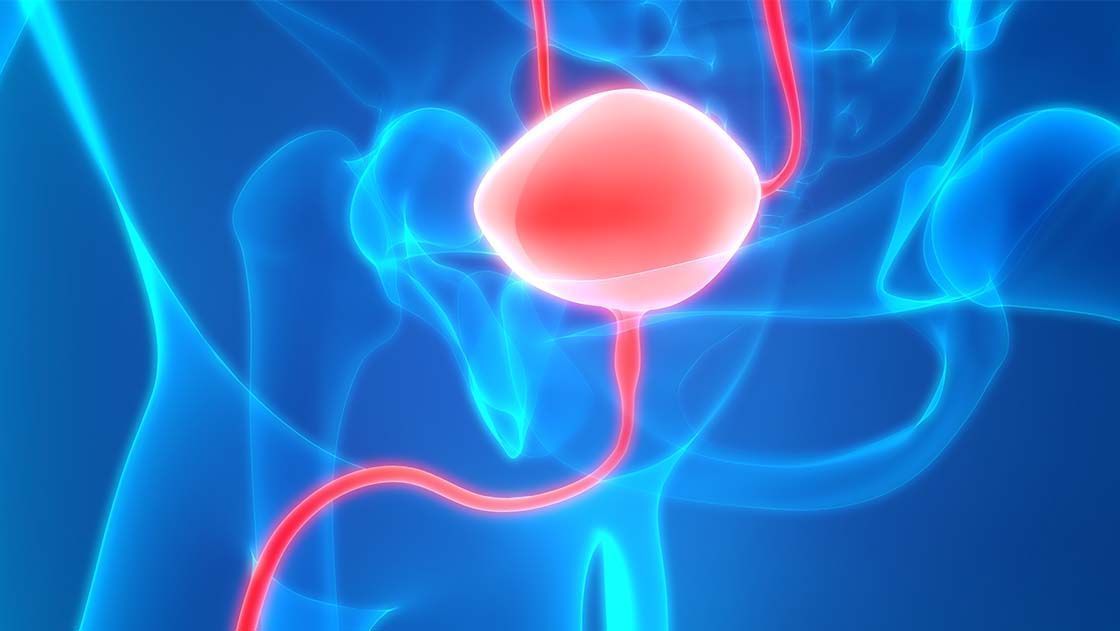 rak sečnega mehurja simptomi diagnostika zdravljenje