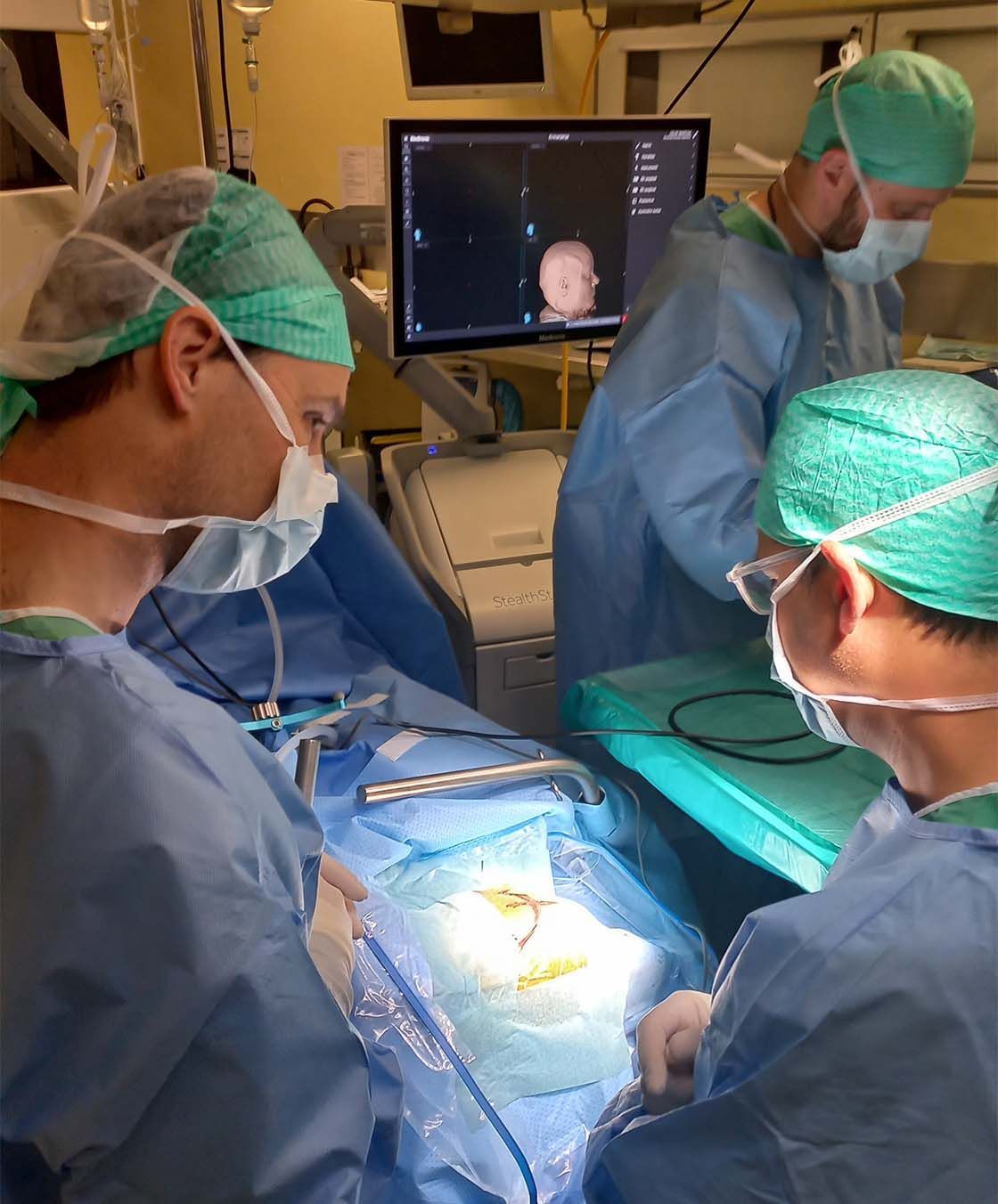 epilepsija – operacija pacientke s kavernomom